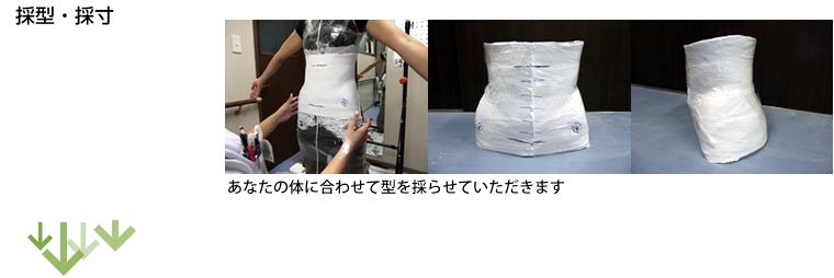 採型・採寸